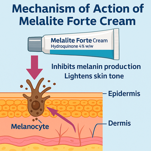 Skin diagram explaining the mechanism of action of Melalite Forte Cream